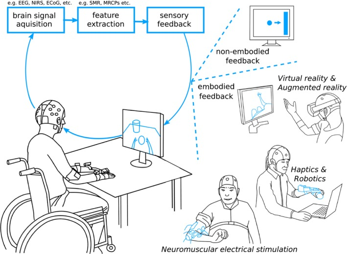 Scignabot: Brain-Robot Interfaces  in neurorehabilitation