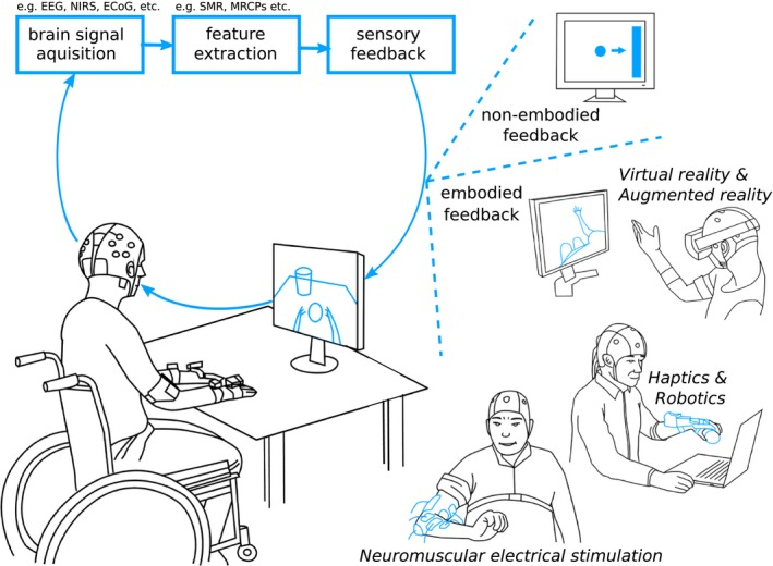 Stroke neurorehabilitation